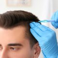 How Over The Counter Hair Loss Treatments Work